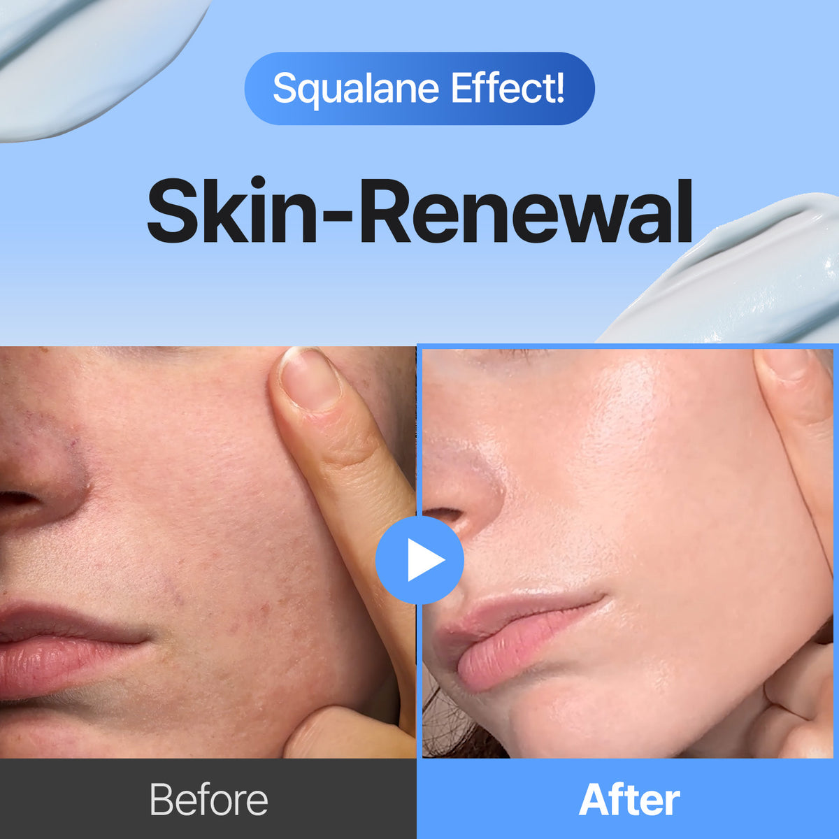 3-Step Korean Glass Skin Trio (FULL) — Retinal, Hyaluronic Acid & Squalane Moisturizer