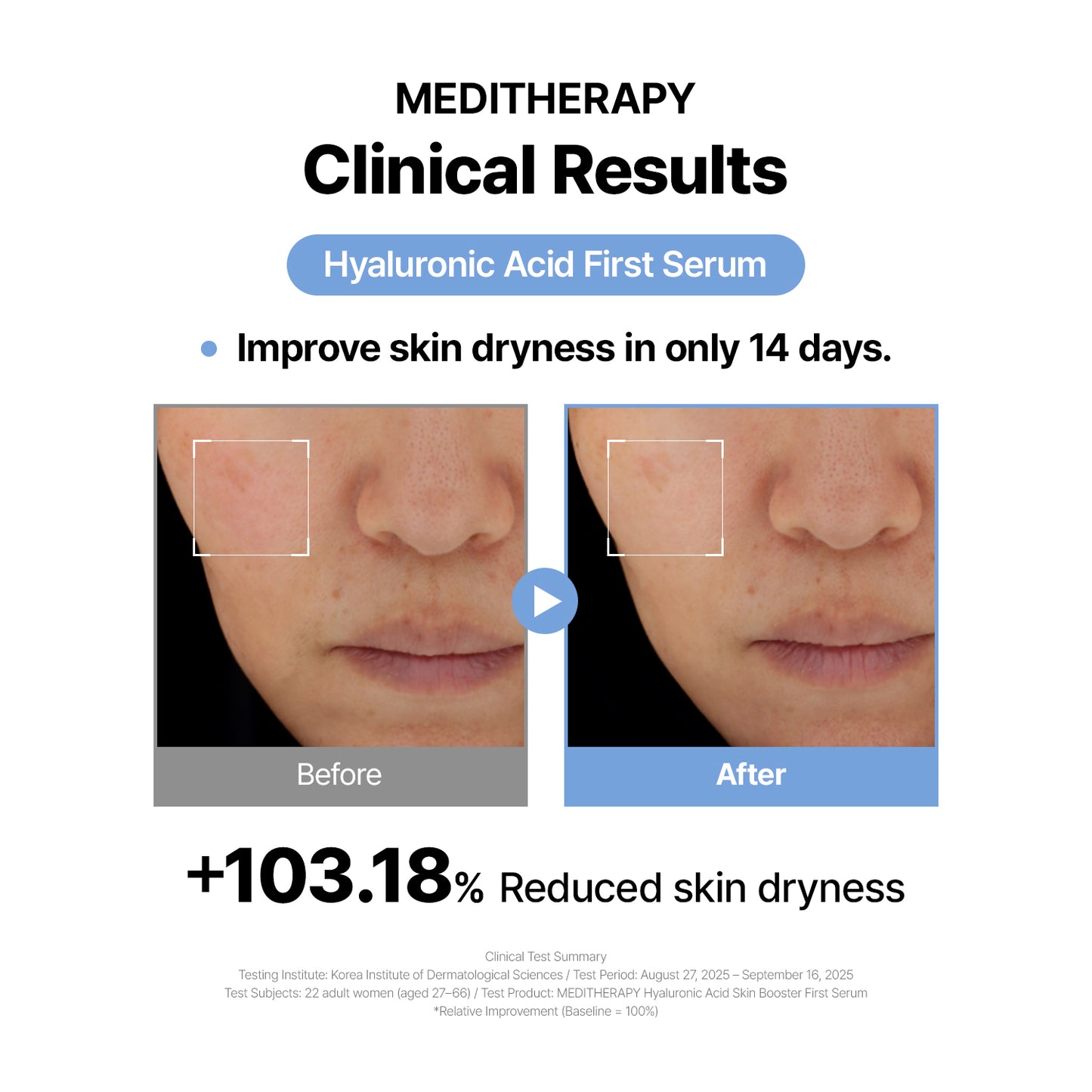 Hyaluronic Acid - Plump & Glow #1 K-Beauty Serum