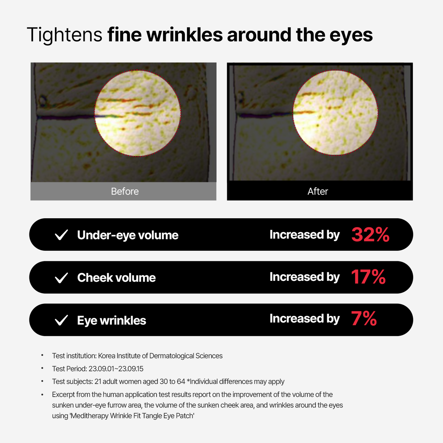 [56%OFF/$9.99] Wrinkle-Fit Tangle Eye Patch – Lowest Price Ever