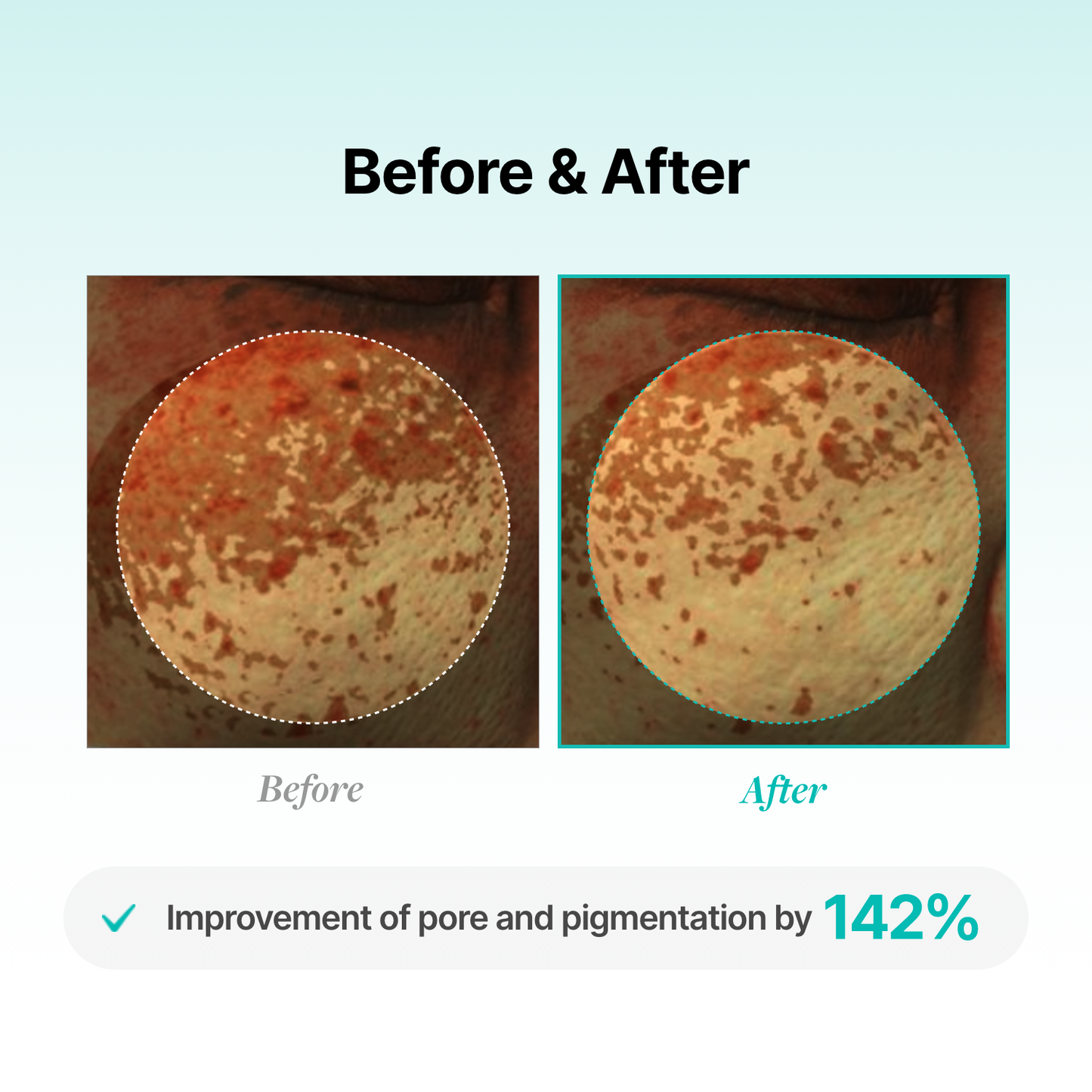 Porethera Real Bifida Blur Cream