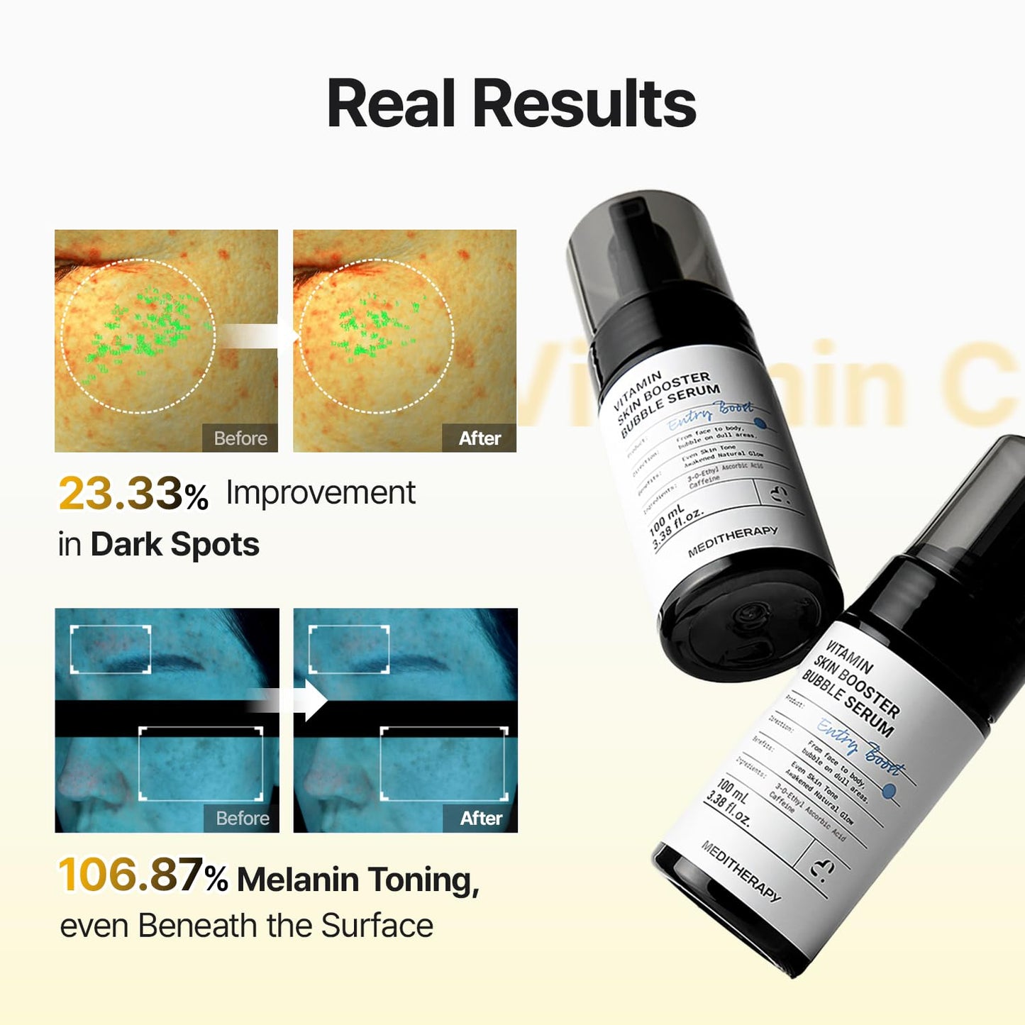 [Amazon | New drop] Vitamin Skin Booster Bubble Serum – Non-Irritating Gentle Daily Brightening