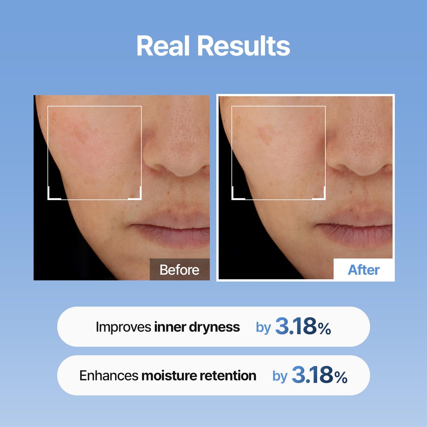 Hyaluronic Acid Skin Booster — Plump & Glow 150ml