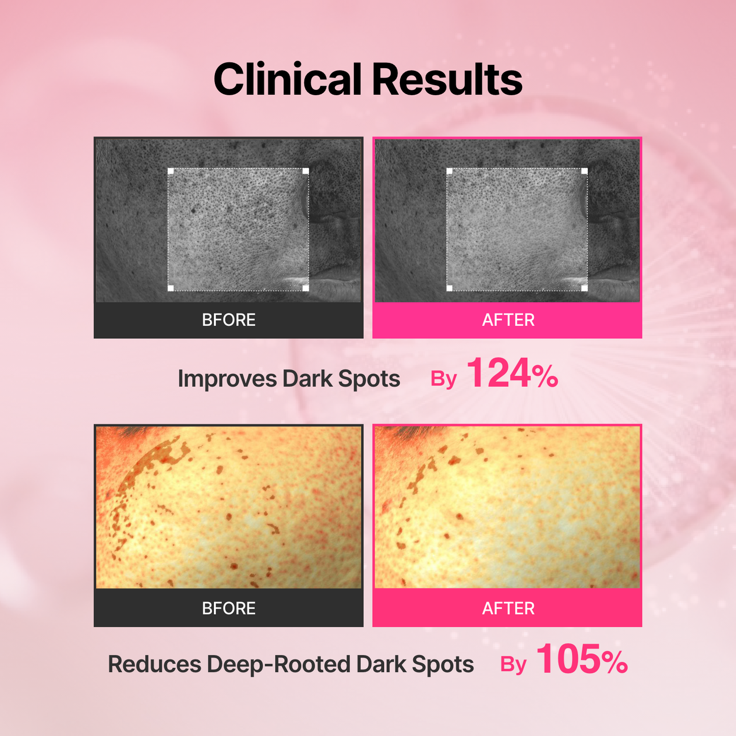 Tranexamic Acid Skin Booster – 4-Week Microcurrent Device & Cream Set