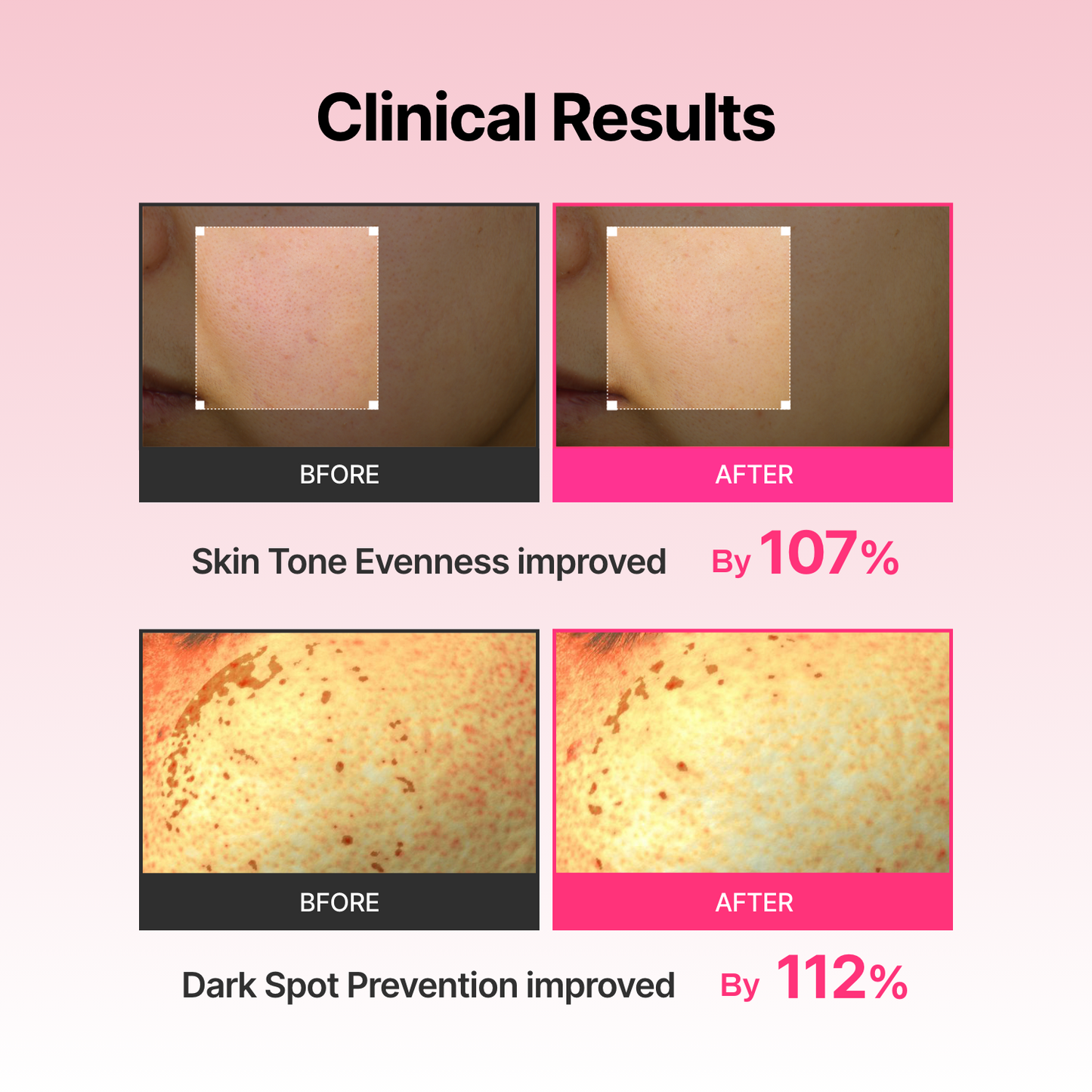 Arbutin Skin Booster Serum