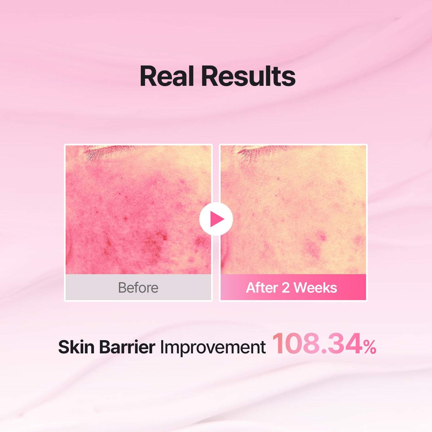 [PONY's K-Beauty Pick] Porethera Real Bifida Pink Blur Cream