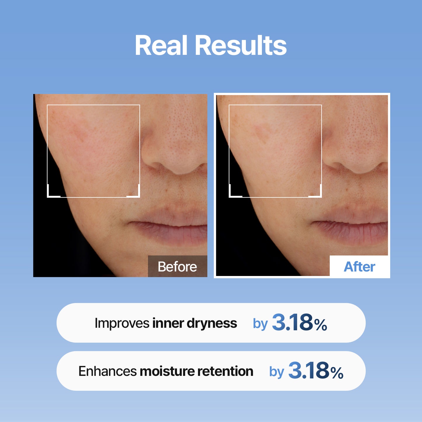 [Amazon | $19.99] Hyaluronic Acid Skin Booster First Serum - 333Serum