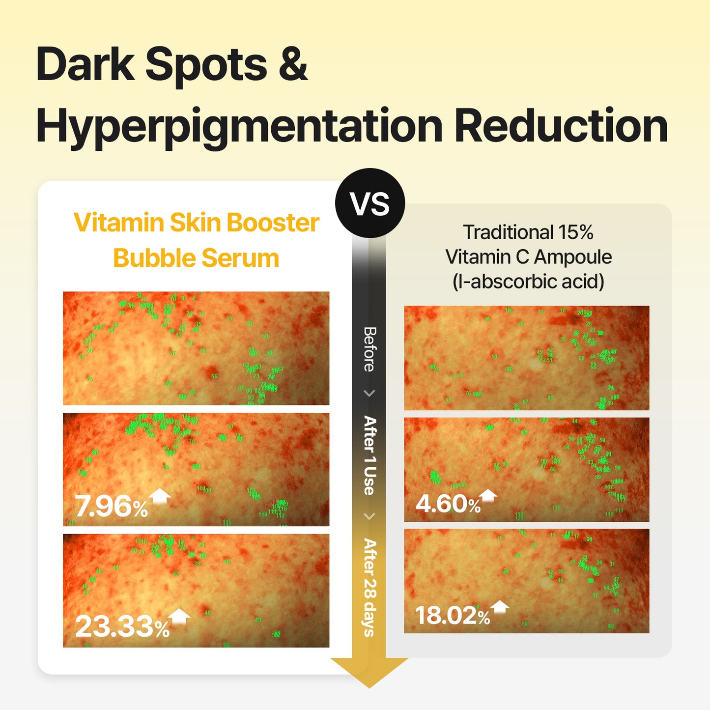 [Amazon's pick] Vitamin Bubble Serum – Even Tone & Dark Spot Fading