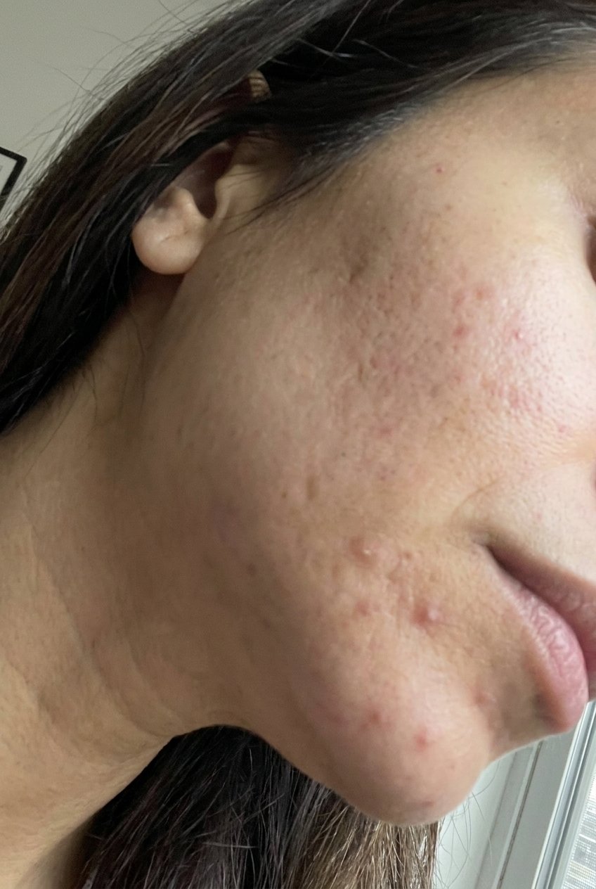 Hyaluronic Acid - Plump & Glow #1 K-Beauty Serum