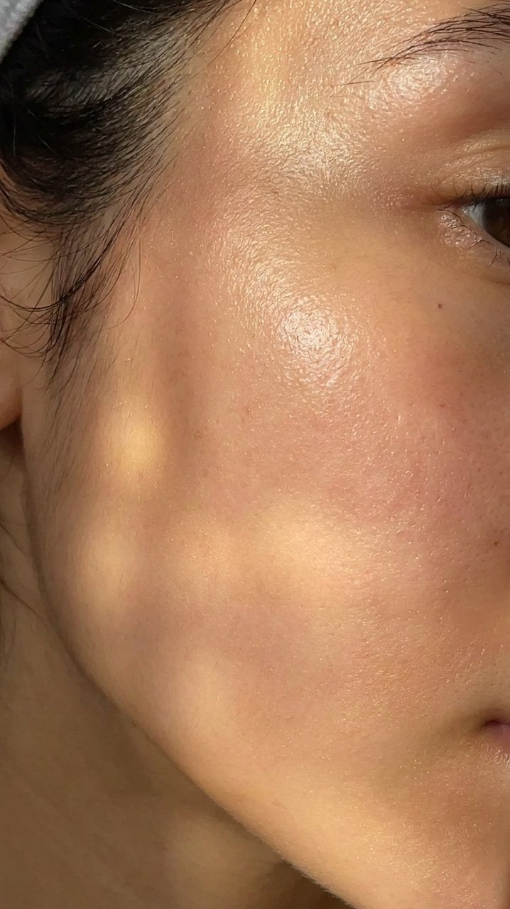 Hyaluronic Acid - Plump & Glow #1 K-Beauty Serum