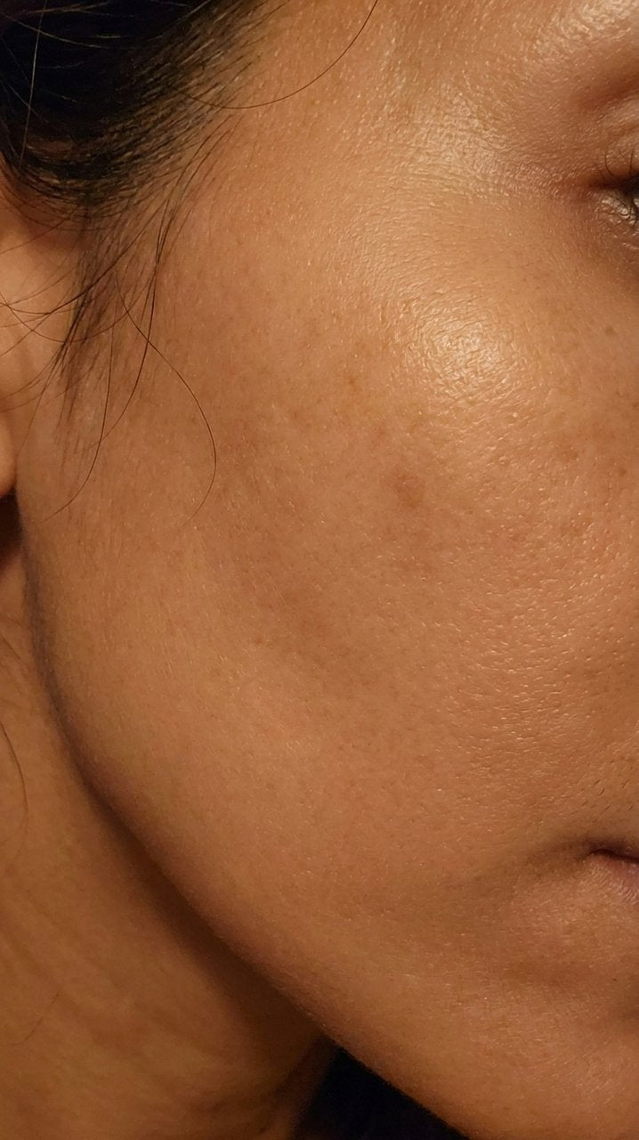 Hyaluronic Acid - Plump & Glow #1 K-Beauty Serum