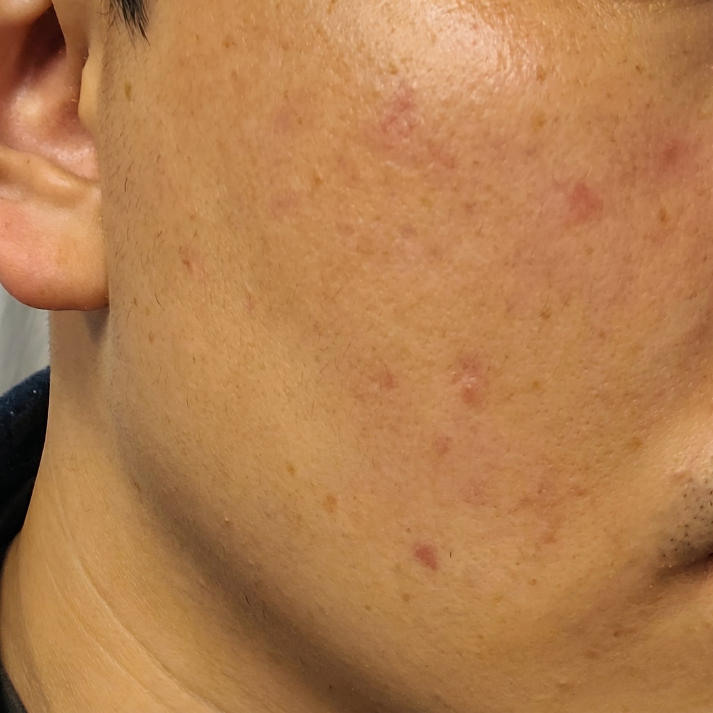 Hyaluronic Acid - Plump & Glow #1 K-Beauty Serum