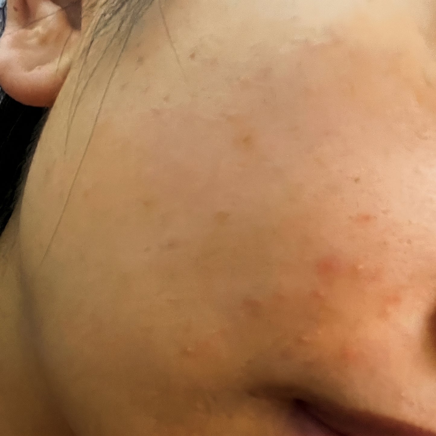 Hyaluronic Acid - Plump & Glow #1 K-Beauty Serum