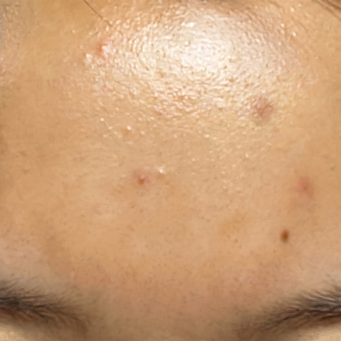 Hyaluronic Acid - Plump & Glow #1 K-Beauty Serum