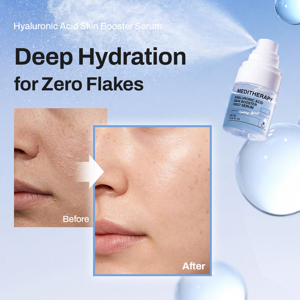 [Amazon's pick] #1 K-Beauty Hyaluronic Serum — Now as Spray Type