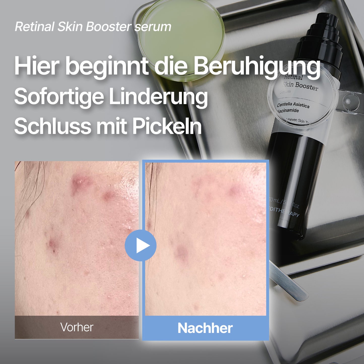 [Amazon Nr. 1] Retinal Skin Booster Serum – Falten- & Fleckenpflege