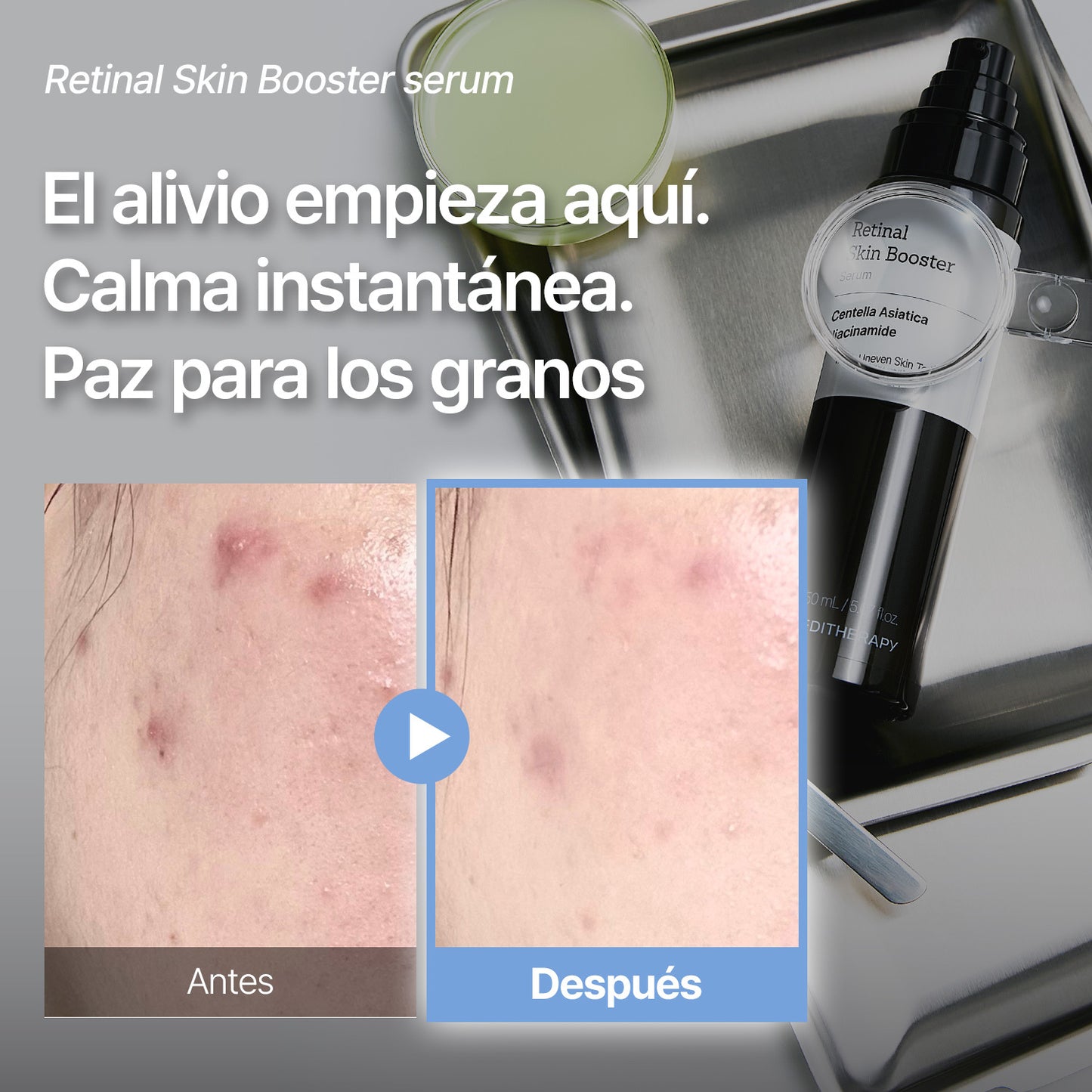 [Amazon n.º 1]Retinal Skin Booster Serum -Antimanchas y antiarrugas