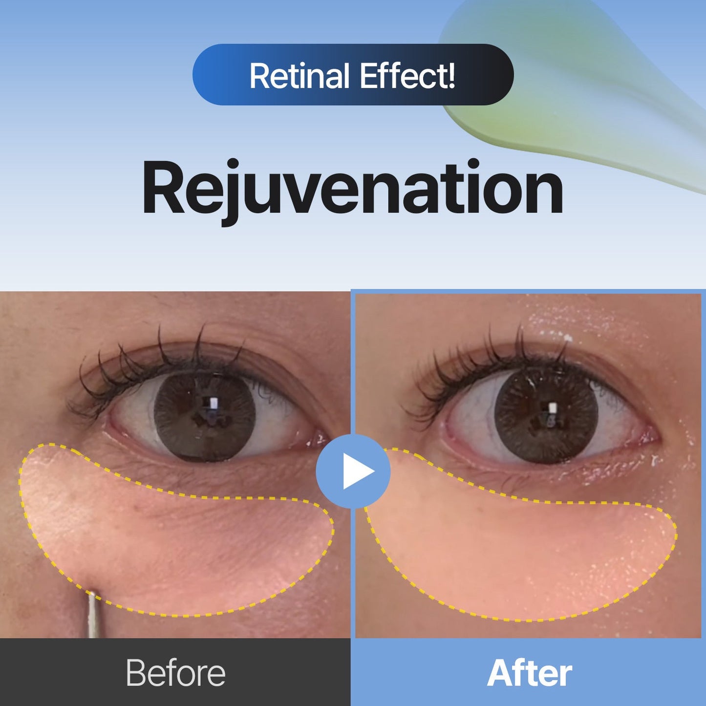 [AMAZON #1] Retinal Skin Booster Serum