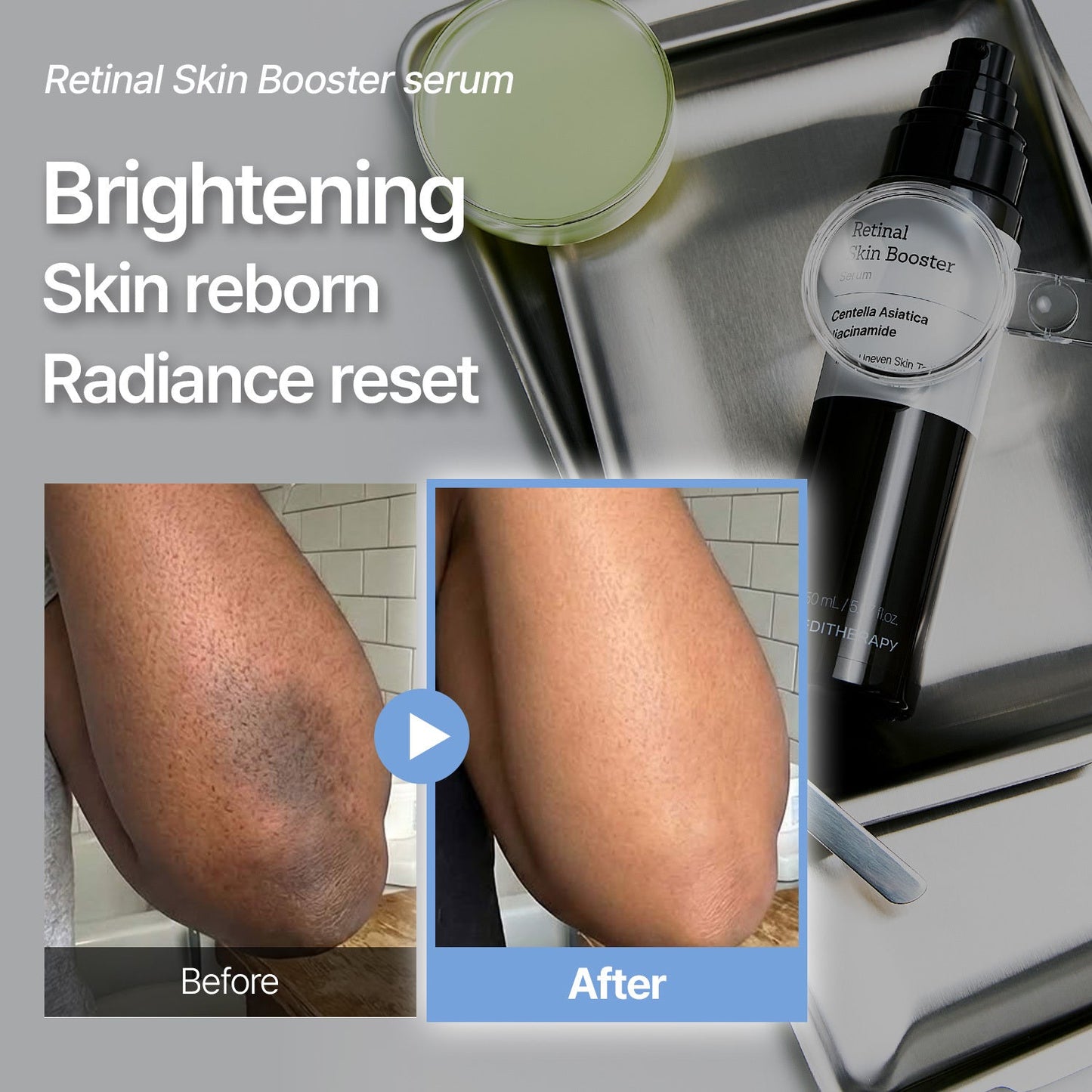 [AMAZON #1] Retinal Skin Booster Serum