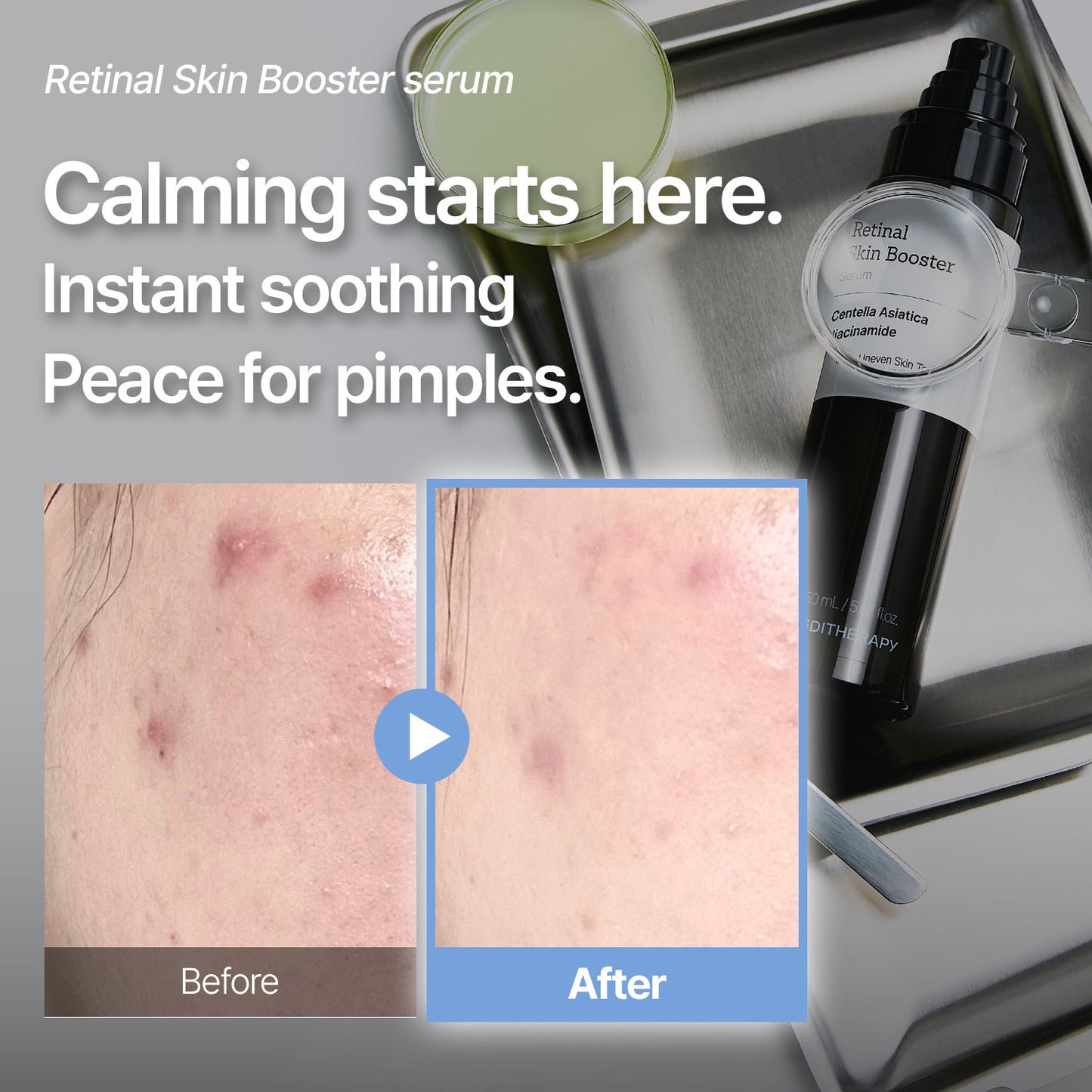 [Amazon #1]Retinal Skin Booster Serum - Dark Spot & Wrinkle care