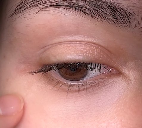Hyaluronic Acid - Plump & Glow #1 K-Beauty Serum