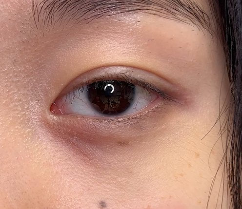 Hyaluronic Acid - Plump & Glow #1 K-Beauty Serum