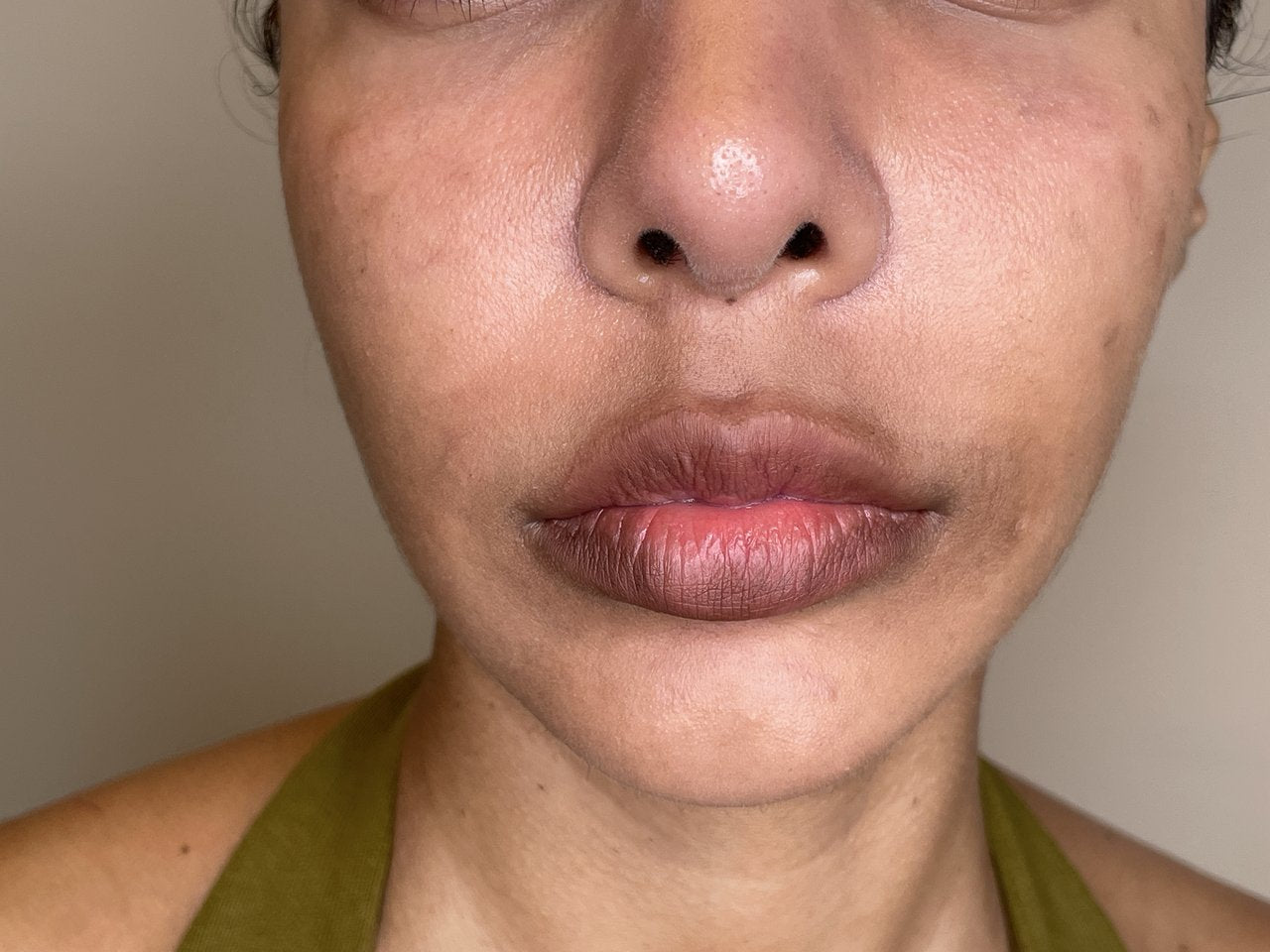 Hyaluronic Acid - Plump & Glow #1 K-Beauty Serum