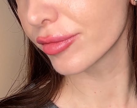 Hyaluronic Acid - Plump & Glow #1 K-Beauty Serum
