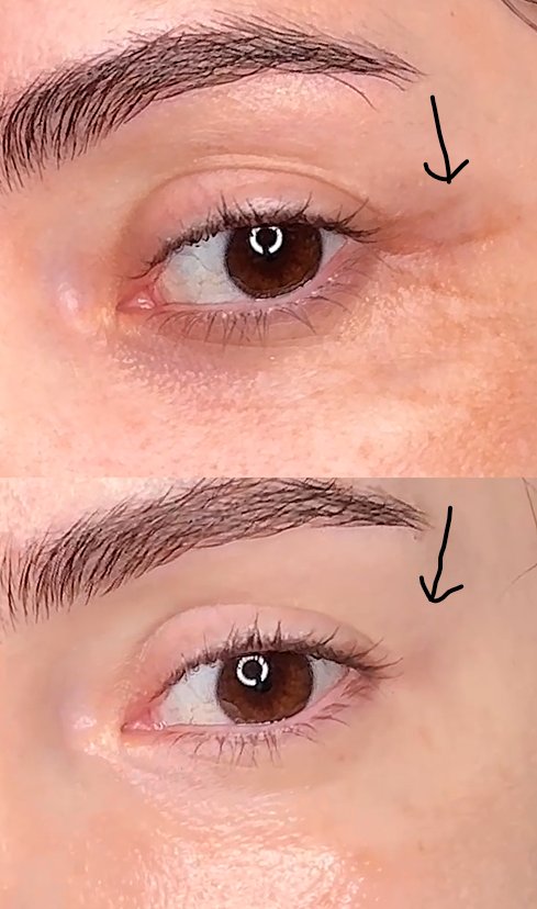 Hyaluronic Acid - Plump & Glow #1 K-Beauty Serum