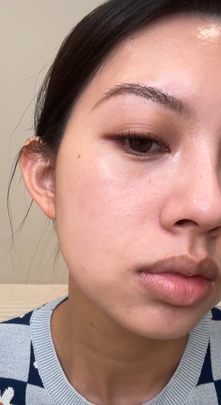 Hyaluronic Acid - Plump & Glow #1 K-Beauty Serum