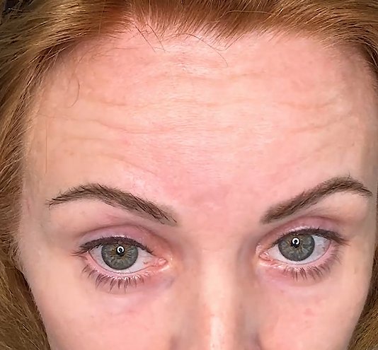 Hyaluronic Acid - Plump & Glow #1 K-Beauty Serum