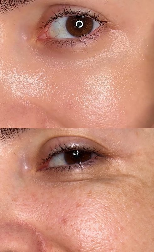 Hyaluronic Acid - Plump & Glow #1 K-Beauty Serum