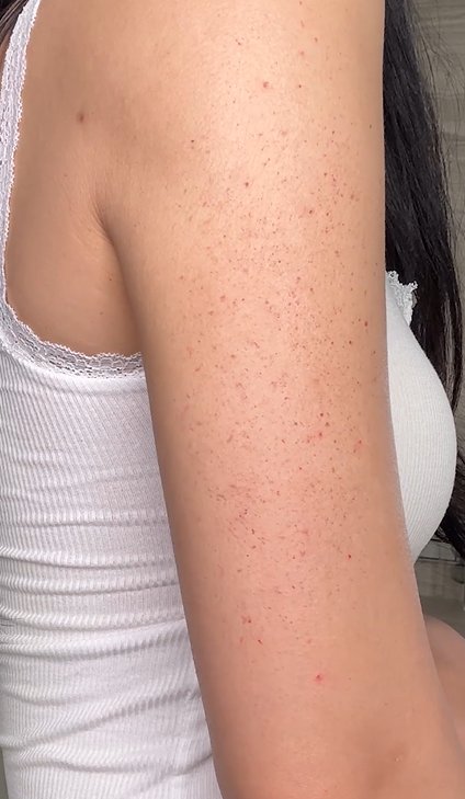 Hyaluronic Acid - Plump & Glow #1 K-Beauty Serum