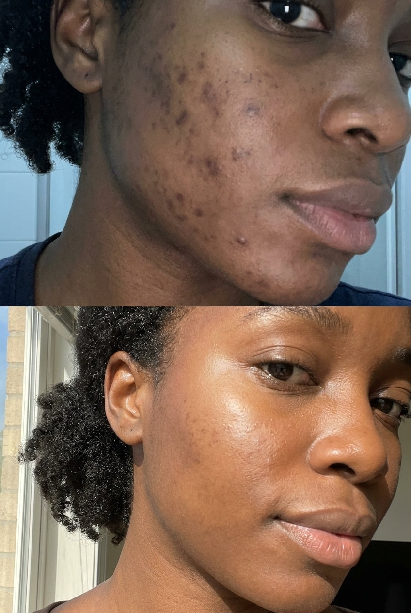 Hyaluronic Acid - Plump & Glow #1 K-Beauty Serum