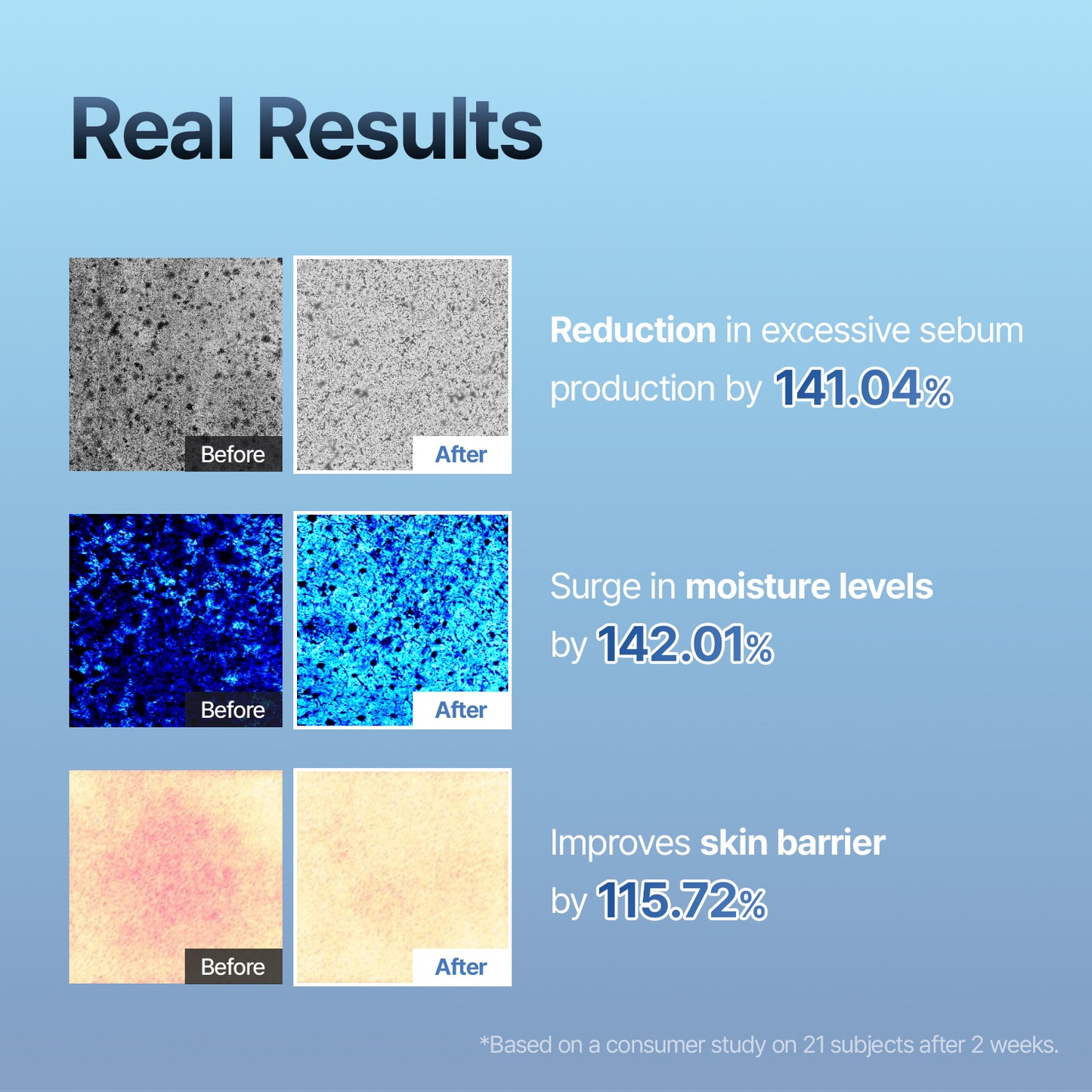 Squalane Moisturizer - Clinically Proven Non-Greasy Barrier Repair